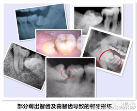 WHATSAPP是什么样的智齿,智能通讯时代的智齿之作